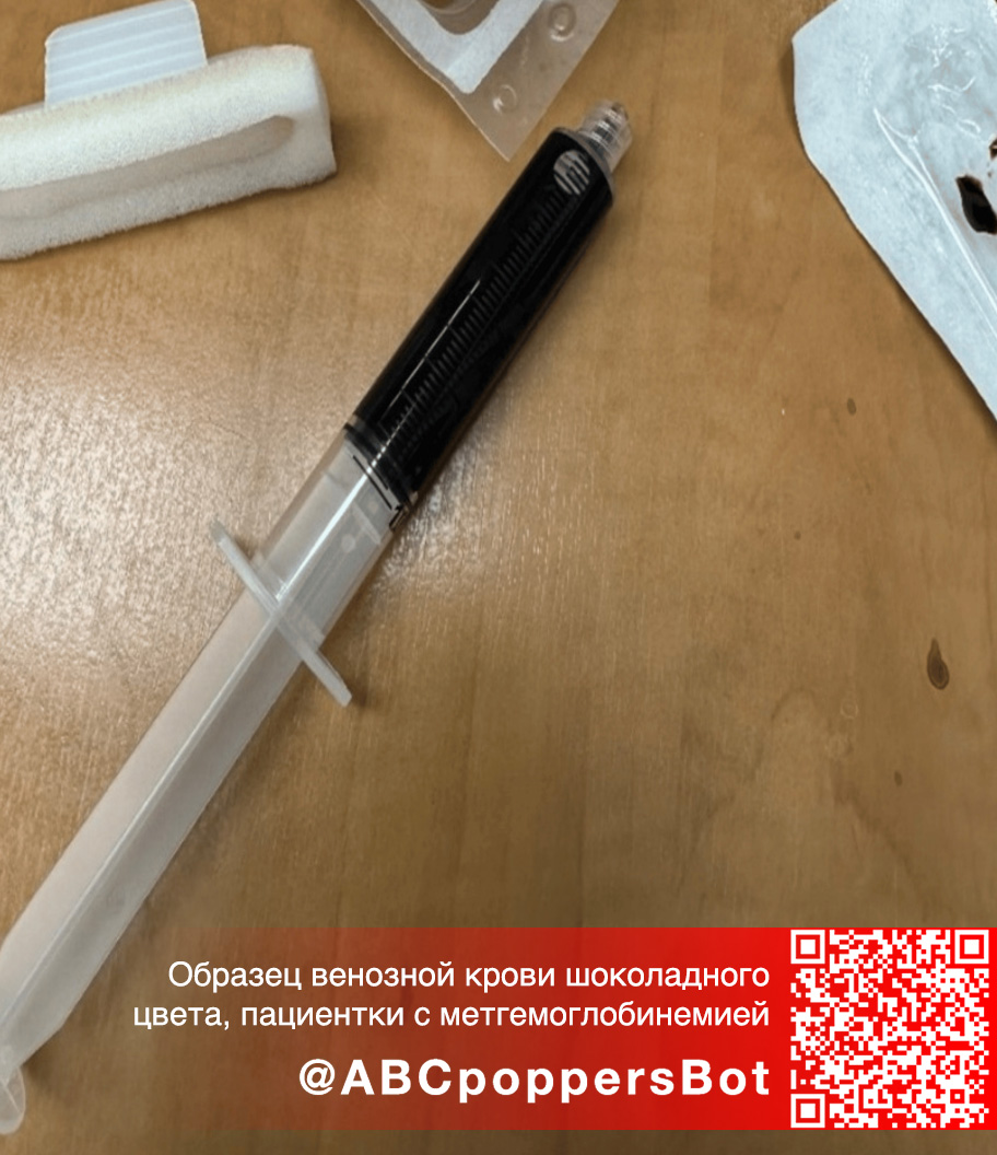 Если принять попперс внутрь в Нижневартовске это вызывает метгемоглобинемию. Смертельное состояние Если принять попперс внутрь в Нижневартовске это вызывает метгемоглобинемию. Смертельное состояние